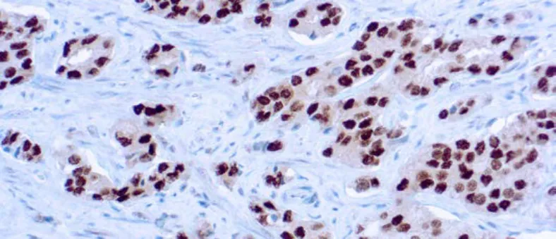 Androgen Receptor (AR 441)
