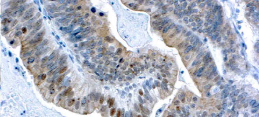 BRCA1