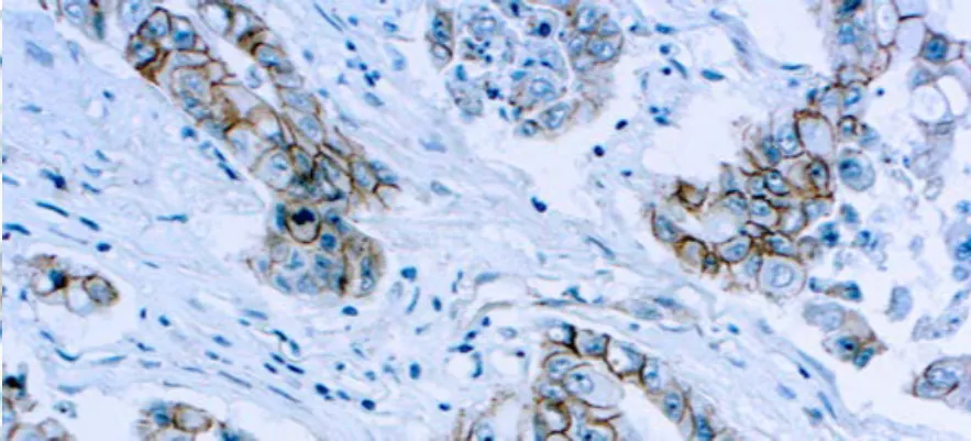 Beta-Catenin