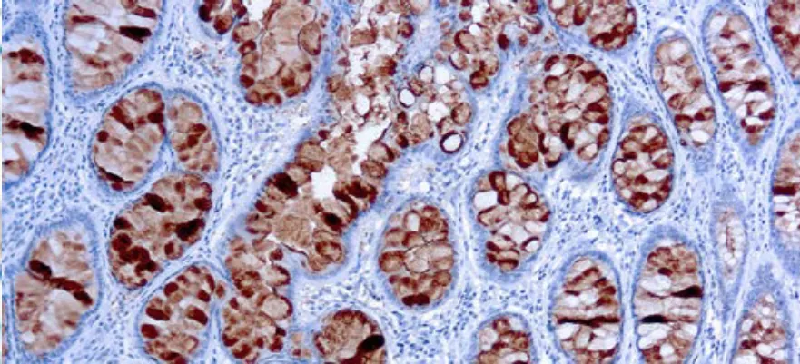 CA 19-9
