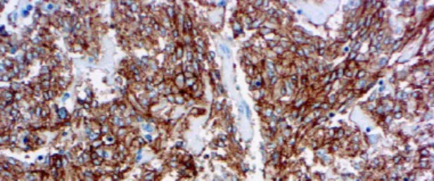Por qué una inmunohistoquímica presenta fondo