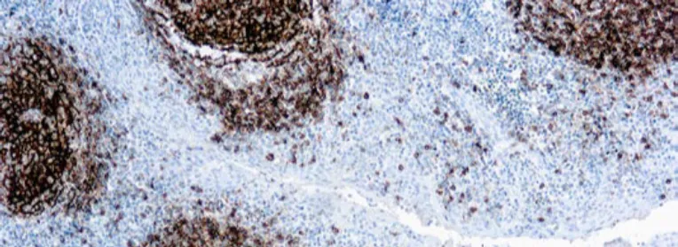 CD23 (1 B12)