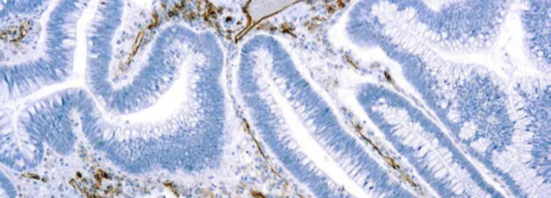 Cómo funciona una inmunohistoquímica, paso por paso
