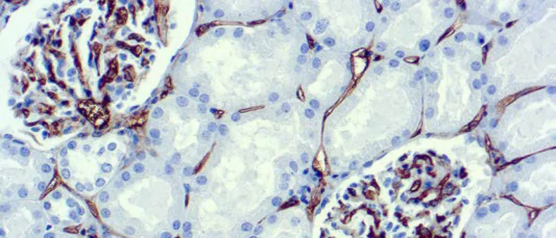 CD34, Célula Endotelial