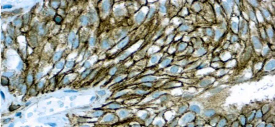 CD44/HCAM