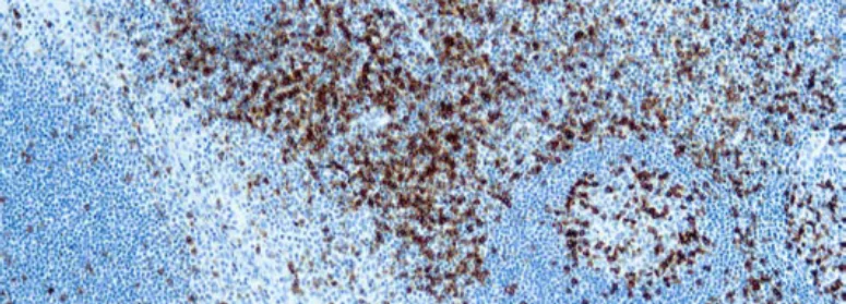CD45RO, Célula T