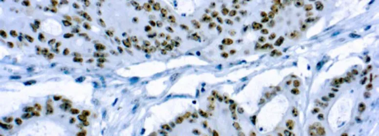 CD56/Neural Cell Adhesion Molecule-1 (NCAM-1)