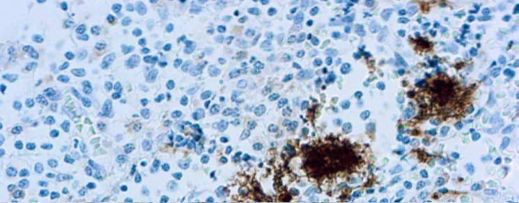 CD61/Glycoprotein IIIa plaquetas