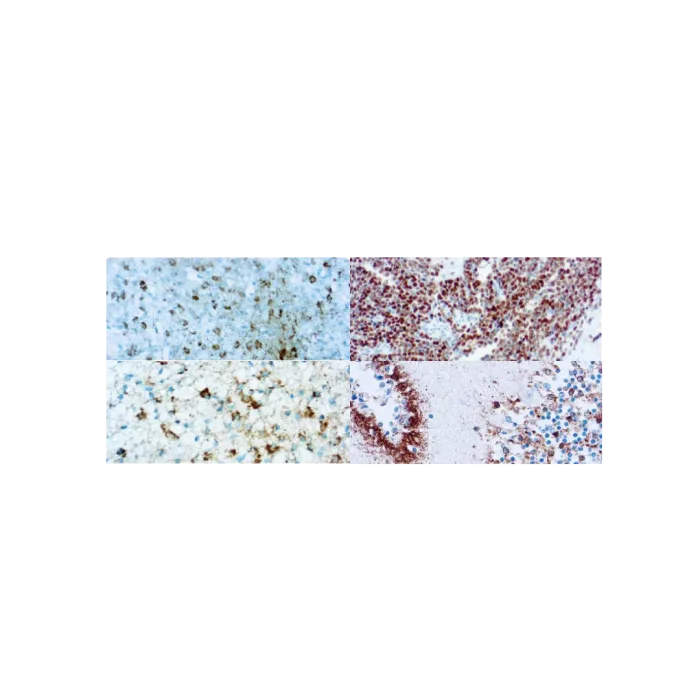 Neurofilamentos (Mob080 / PDM012)