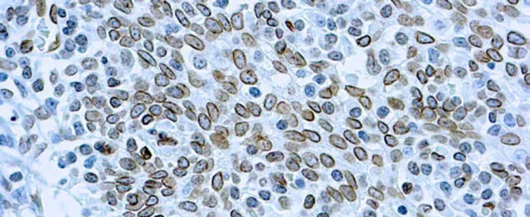 Cdc25A