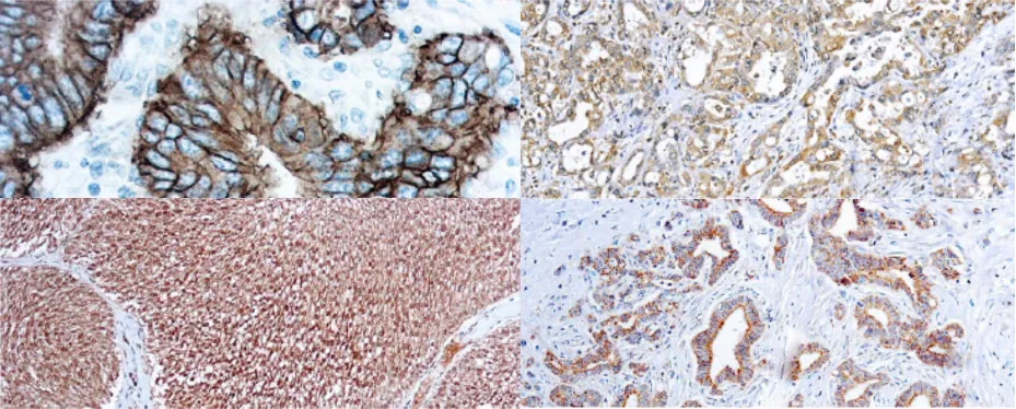 CD4 Células endoteliales