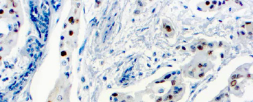Ciclina D1 (SP4)