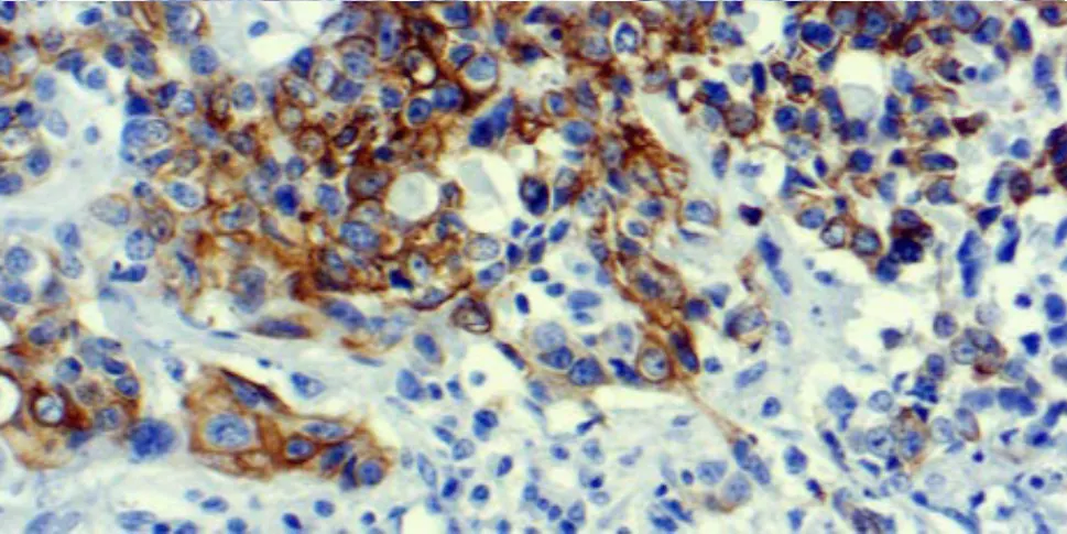 Cytokeratin 7 (LP1K)