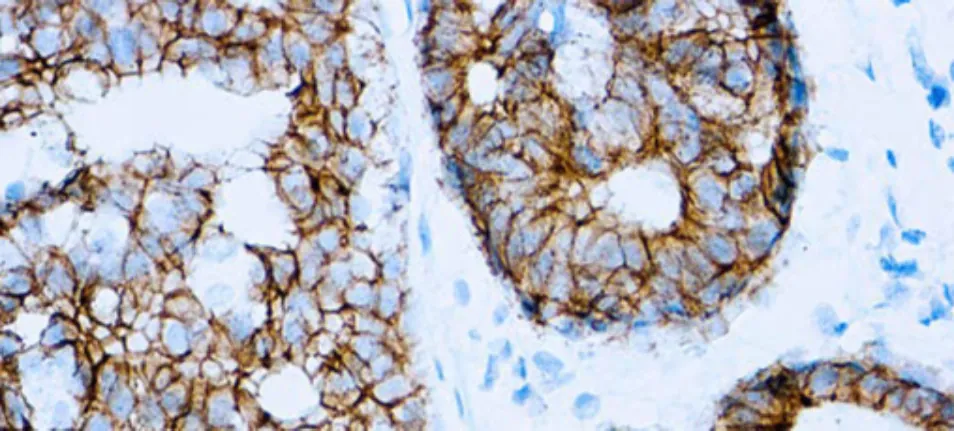 E-Cadherin (SPM471)