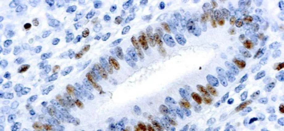 E2F-1 Transcription Factor