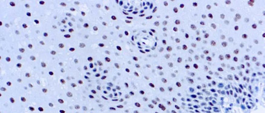 ERCC1