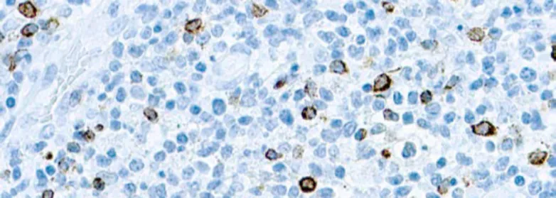 Epstein-Barr Virus (EBV)
