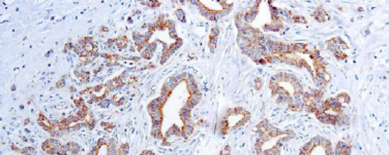 Factor de Crecimiento Endotelial Vascular (VEGF) (VG1)