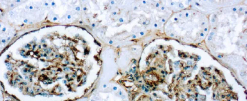 Fibronectina