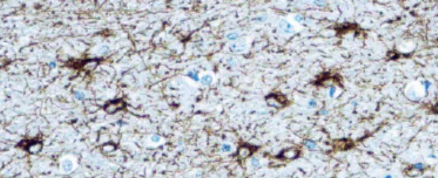 Glial Fibrillary Acidic Protein (GFAP) (GA5)