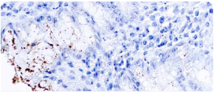contra Helicobacter pylori