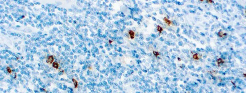 Mast Cell Tryptase