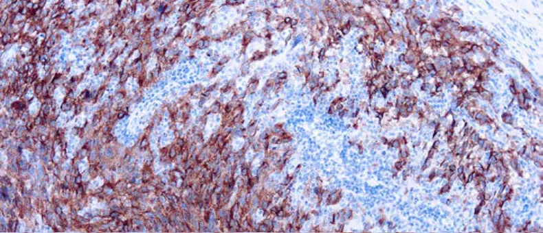 Melanoma Cocktail Antibody