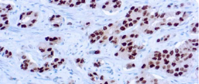 Cómo elegir un anticuerpo para inmunohistoquímica