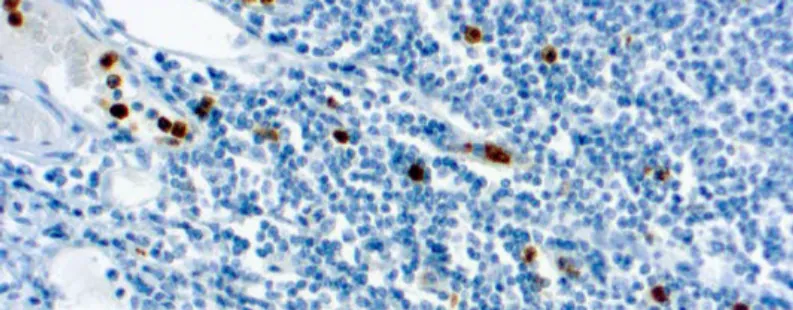 Myeloperoxidase (59A5)