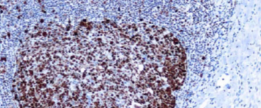Proliferating Cell Nuclear Antigen (PCNA) (PC10)