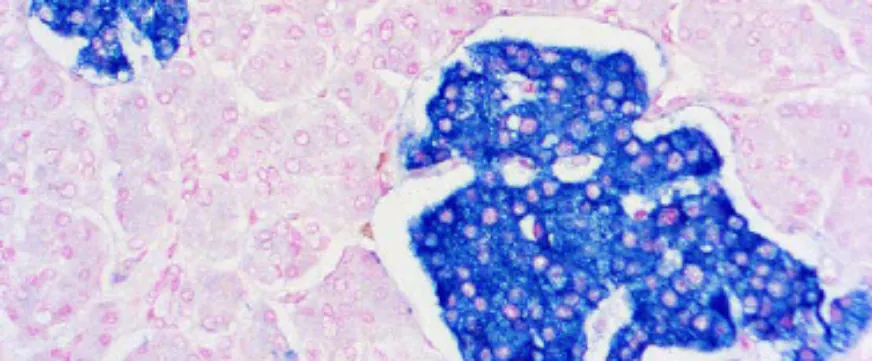 Synaptophysin (SP11)