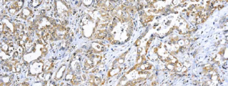 TNF-alpha (Tumor Necrosis Factor alpha)