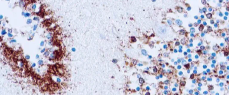 Tau (Neurofibrillary Tangles Marker)