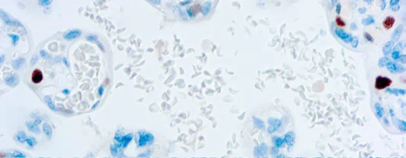 p57Kip2 (57P06)